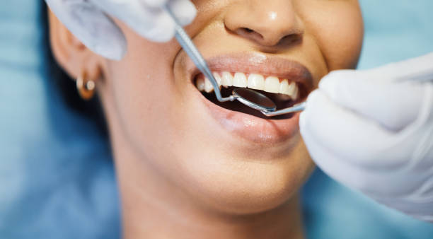 Best Emergency Treatment for Toothache in Park City, MT
