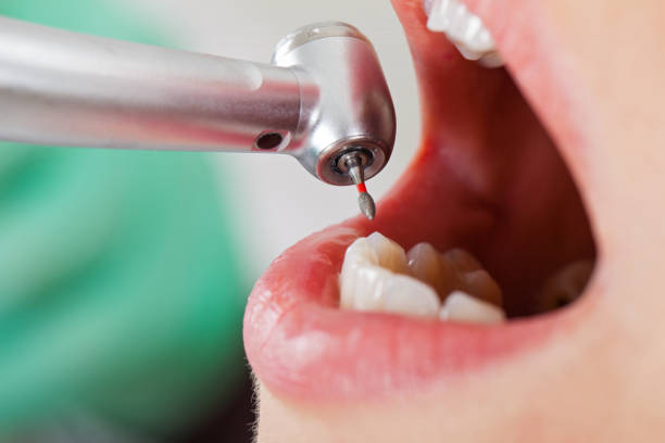 Professional Emergency Dentist in MT